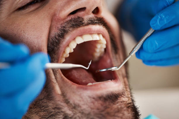 Best Emergency Cosmetic Dentistry in Fairfield Harbour, NC